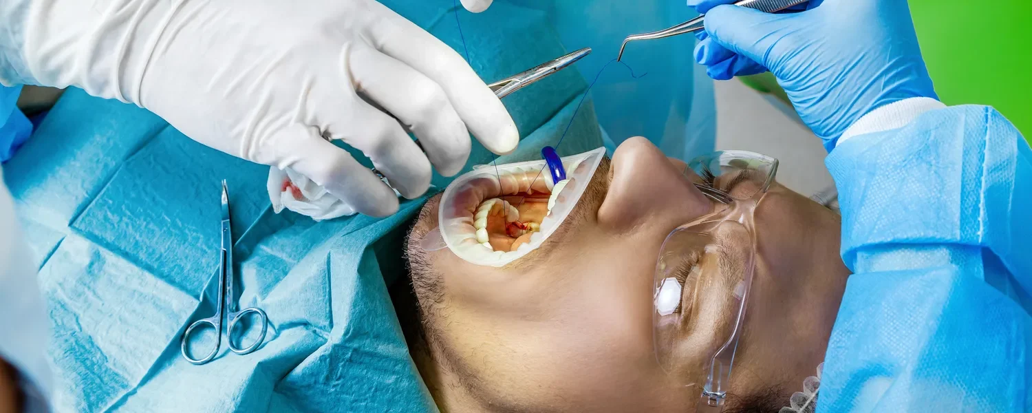 Ile kosztuje implant zęba